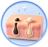 Blackheads