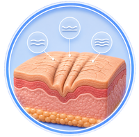 Finelines & Wrinkles